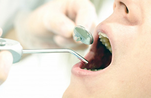 お口全体の健康をサポート さくら 南草津の歯医者